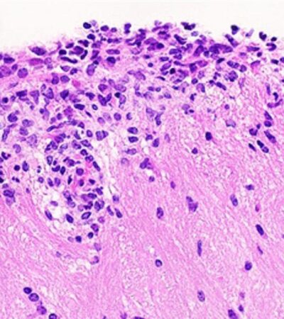 An adaptive cellular source of IL-17A and IL-17F is critical for the induction of experimental autoimmune encephalomyelitis | Science Immunology