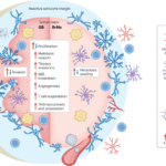 Astrocyte-driven immunosuppression in the brain tumor microenvironment