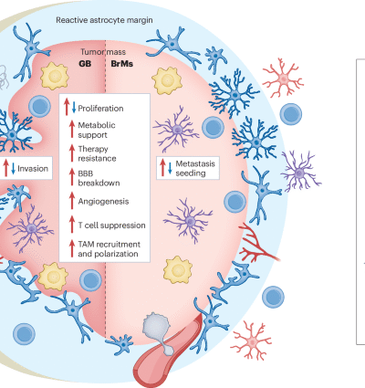 Astrocyte-driven immunosuppression in the brain tumor microenvironment