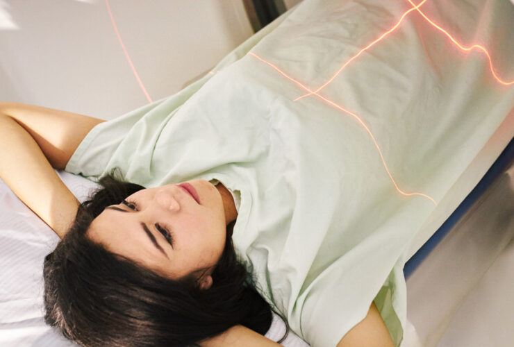 BRCA Gene Mutations Are Linked to 4 Cancers, Study Finds