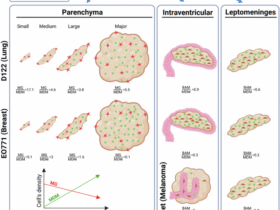 Brain metastases exhibit distinct spatial patterns of resident and infiltrating macrophages