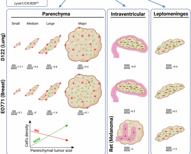 Brain metastases exhibit distinct spatial patterns of resident and infiltrating macrophages