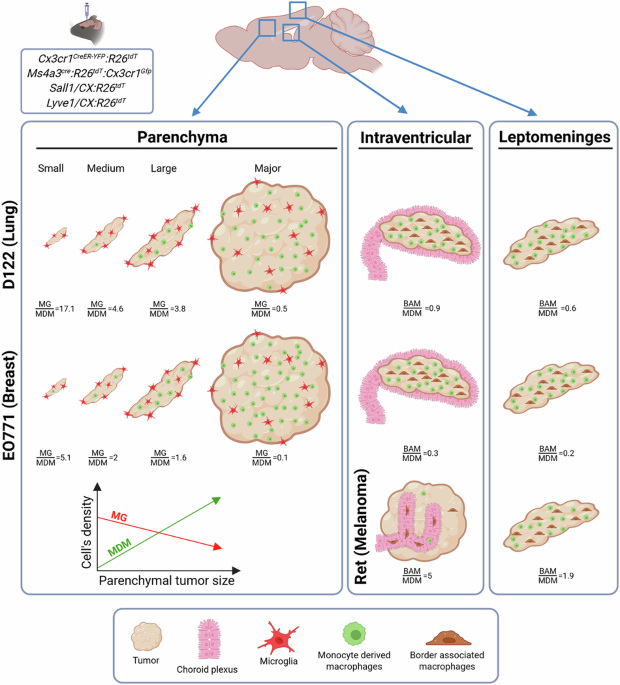 Brain metastases exhibit distinct spatial patterns of resident and infiltrating macrophages