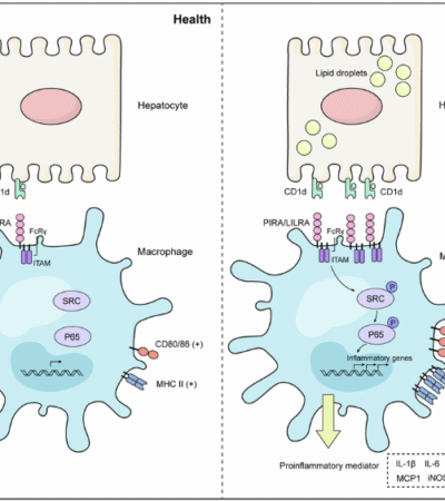 CD1d functions as a ligand for PIRA2 to drive macrophage activation in nonalcoholic fatty liver disease