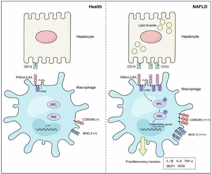 CD1d functions as a ligand for PIRA2 to drive macrophage activation in nonalcoholic fatty liver disease