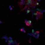 Claudins interact with LILRB immune inhibitory receptors to promote myeloid immunosuppression in cancer | Science Immunology