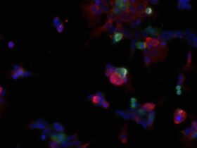 Claudins interact with LILRB immune inhibitory receptors to promote myeloid immunosuppression in cancer | Science Immunology