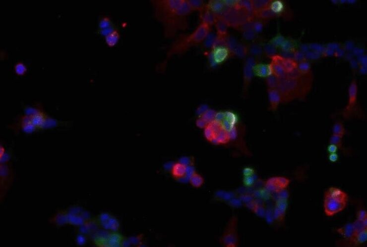 Claudins interact with LILRB immune inhibitory receptors to promote myeloid immunosuppression in cancer | Science Immunology
