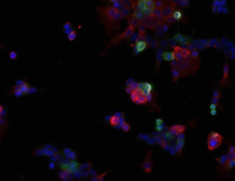 Claudins interact with LILRB immune inhibitory receptors to promote myeloid immunosuppression in cancer | Science Immunology