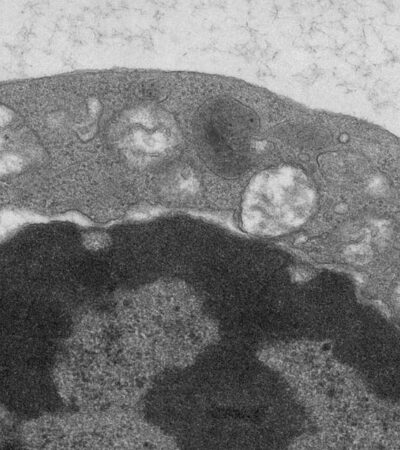 Copper supports regulatory T cell energetic state to sustain peripheral immune tolerance | Science Immunology