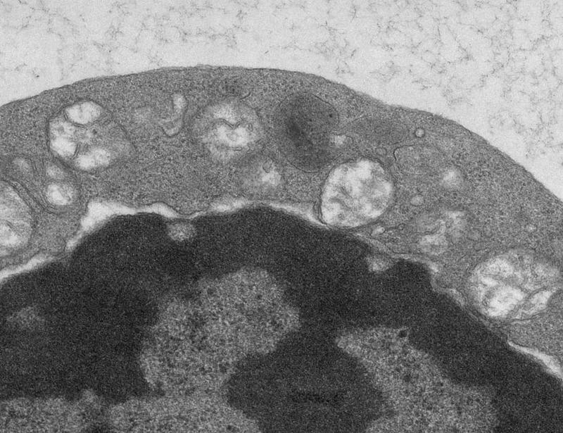 Copper supports regulatory T cell energetic state to sustain peripheral immune tolerance | Science Immunology