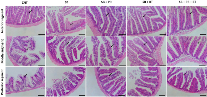 Countering the negative effects of dietary soybean (SB) meal in Nile tilapia with organic acid salts