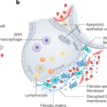 Developing a vaccine strategy to prevent the progression of pulmonary fibrosis