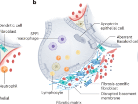 Developing a vaccine strategy to prevent the progression of pulmonary fibrosis
