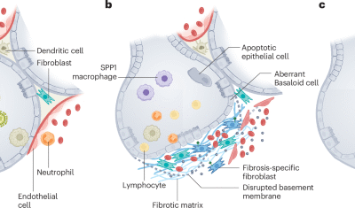 Developing a vaccine strategy to prevent the progression of pulmonary fibrosis