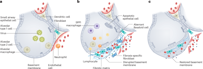 Developing a vaccine strategy to prevent the progression of pulmonary fibrosis