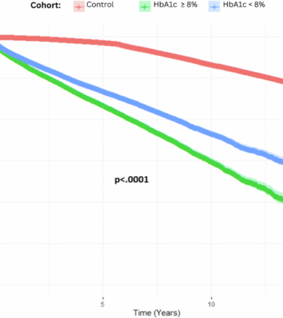 Diabetes and uveitis. A large cohort evaluation of the association between glycaemic control and incident undifferentiated anterior uveitis. (The DULCE Study)
