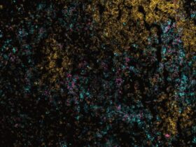 Divergent granulopoiesis at extramedullary sites safeguards antibacterial host defense | Science Immunology