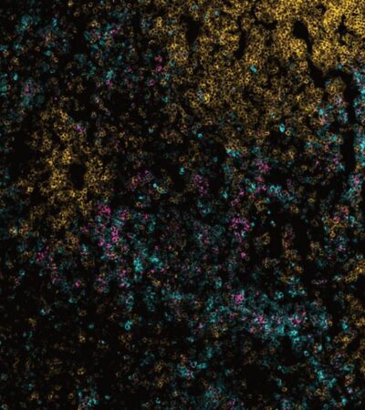 Divergent granulopoiesis at extramedullary sites safeguards antibacterial host defense | Science Immunology