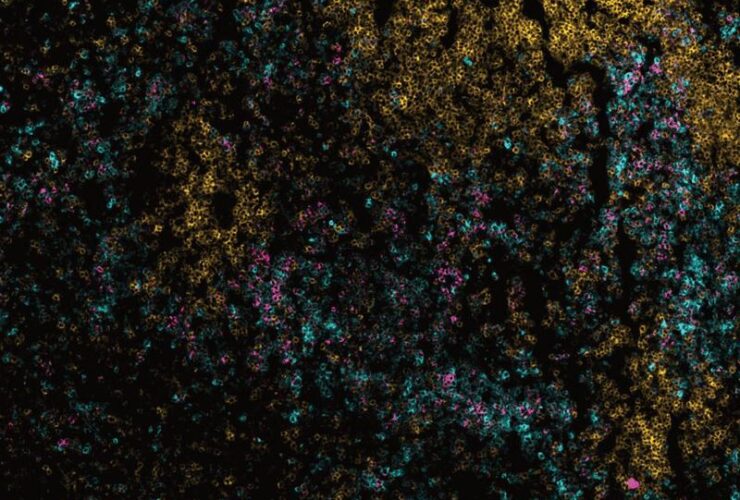 Divergent granulopoiesis at extramedullary sites safeguards antibacterial host defense | Science Immunology