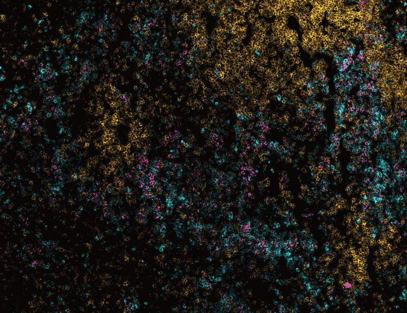 Divergent granulopoiesis at extramedullary sites safeguards antibacterial host defense | Science Immunology