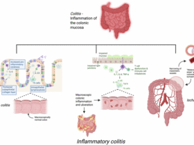 Drug-induced inflammatory colitis: a review of novel agents