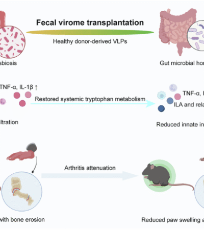 Fecal virome transplantation attenuates arthritis in mice by remodeling gut ecology, systemic tryptophan metabolism, and innate immune responses