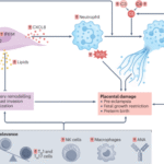 Fertility, pregnancy and lactation in women with systemic lupus erythematosus
