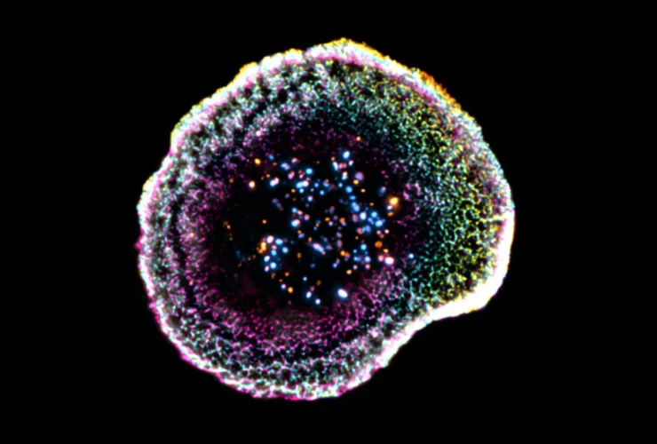 First-ever 3D view shows how killer T cells destroy cancer