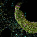 Gene delivery of immunomodulatory cytokines to the lung preserves respiratory function during inflammatory challenge | Science Immunology