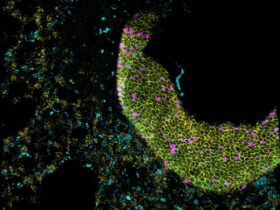 Gene delivery of immunomodulatory cytokines to the lung preserves respiratory function during inflammatory challenge | Science Immunology