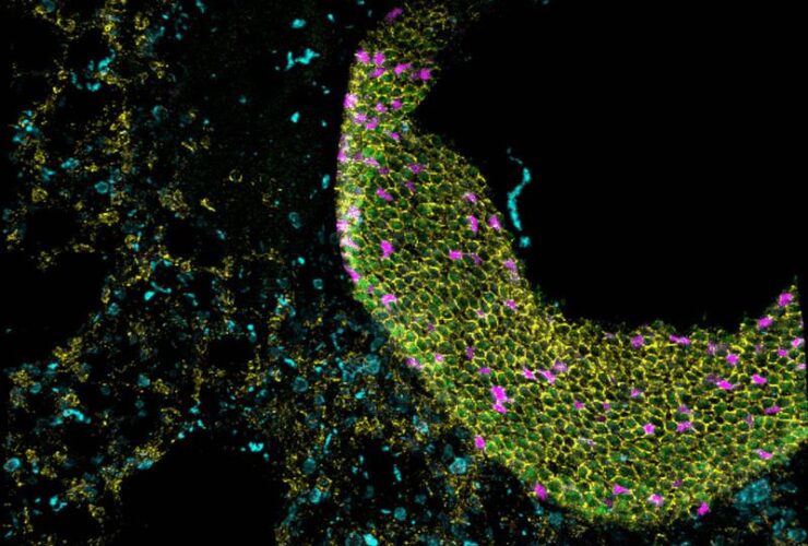 Gene delivery of immunomodulatory cytokines to the lung preserves respiratory function during inflammatory challenge | Science Immunology