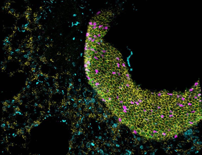 Gene delivery of immunomodulatory cytokines to the lung preserves respiratory function during inflammatory challenge | Science Immunology