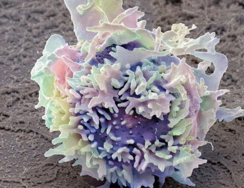 Intratumoral Treg cell ablation elicits NK cell–mediated control of CD8 T cell–resistant tumors | Science Immunology