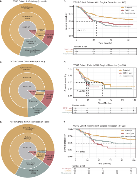 Lethal clinical outcome and immune desert contexture in refractory gastric cancer harboring CCNE1 amplification and overexpression