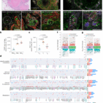 Lipid accumulation in tuberculosis granulomas inhibits macrophage–CD4+ T cell interactions and infection control