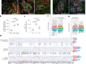 Lipid accumulation in tuberculosis granulomas inhibits macrophage–CD4+ T cell interactions and infection control