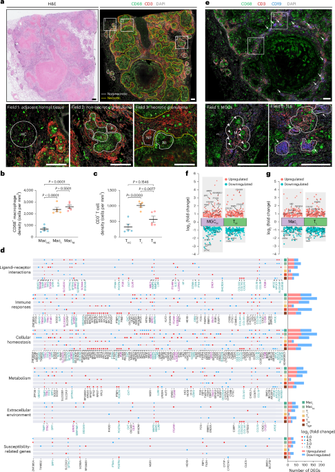 Lipid accumulation in tuberculosis granulomas inhibits macrophage–CD4+ T cell interactions and infection control