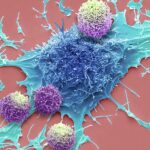Long-lived immune cells show promise against cancer in world-first trial