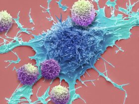 Long-lived immune cells show promise against cancer in world-first trial