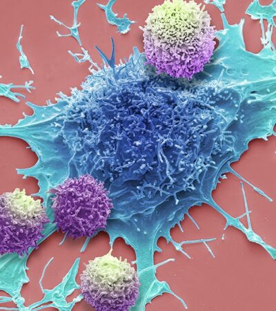 Long-lived immune cells show promise against cancer in world-first trial