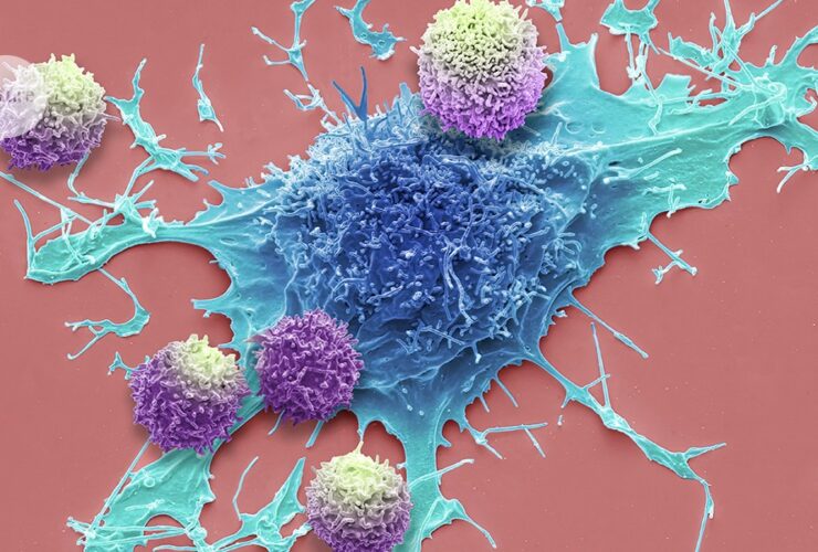Long-lived immune cells show promise against cancer in world-first trial
