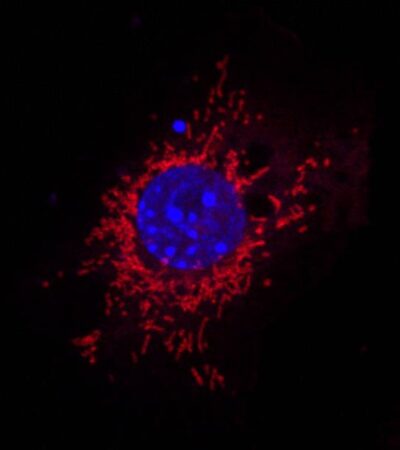 Mitochondrial fission mediates an evolutionarily conserved antibacterial defense response | Science Immunology
