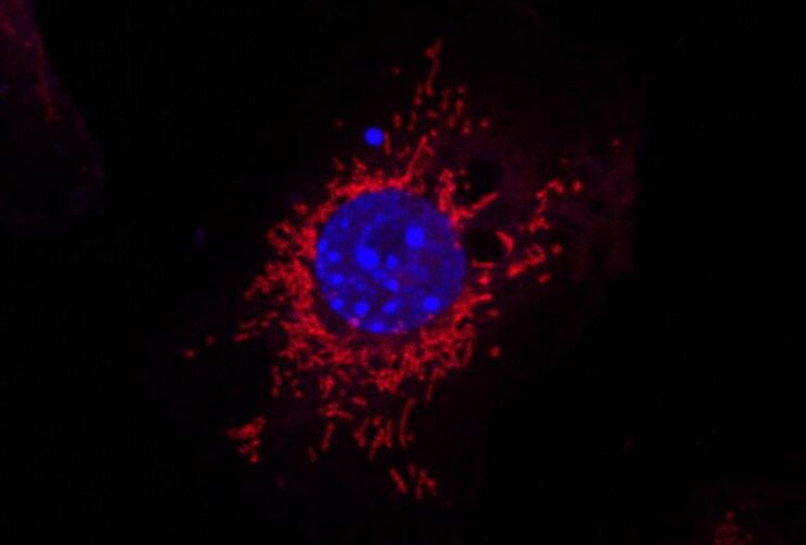 Mitochondrial fission mediates an evolutionarily conserved antibacterial defense response | Science Immunology