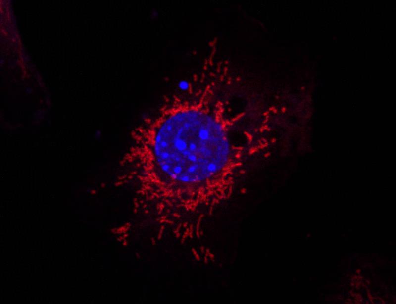 Mitochondrial fission mediates an evolutionarily conserved antibacterial defense response | Science Immunology