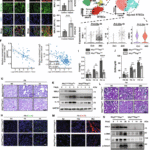 NINJ1 ubiquitination by TRIM72 protects against plasma membrane rupture and AKI-CKD progression