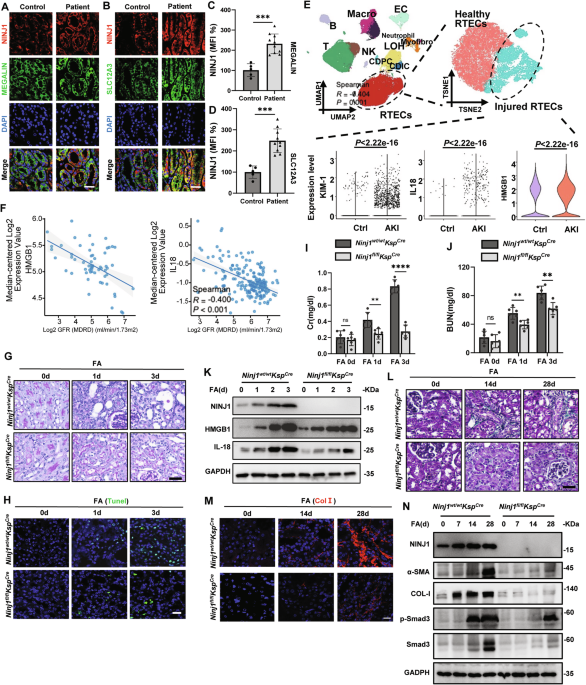 NINJ1 ubiquitination by TRIM72 protects against plasma membrane rupture and AKI-CKD progression