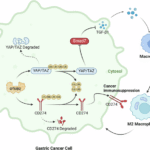 OTUB2 induces M2 tumor-associated macrophage polarization and increases CD274 expression in gastric cancer cells to aggravate the progression of gastric cancer