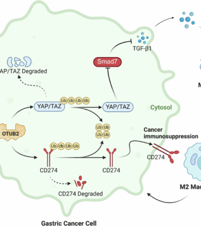 OTUB2 induces M2 tumor-associated macrophage polarization and increases CD274 expression in gastric cancer cells to aggravate the progression of gastric cancer