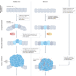 Pathophysiology of colitis-associated colorectal cancer